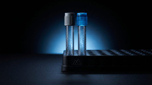 HOMA-IR: How to Calculate It From Two Labs, and What Is Optimal